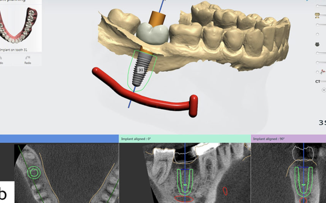 The Rise Of Digital Dentistry