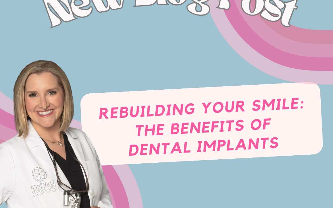 Rebuilding Your Smile: The Benefits of Dental Implants